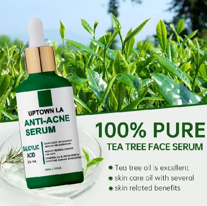 UPTOWN LA Anti Acne Serum 30ml ,Pimple Remove Serum, Dark Spot Remover, Acne Scar Serum, Oil Control Serum, Blackhead Remover Serum, Glowing Skin Serum, Whitening Acne Serum, Best Serum for Pimples, Oily Skin Care Serum, Face Serum for Men, Face Serum