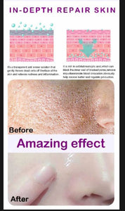 UPTOWN LA PORE REFINING Serum with lactobionic acid and Niacinamide For shrinking pores For all skin types 30 ML