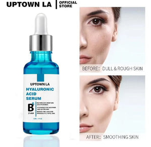 Non greasy Paraben free Hyaluronic Acid for Your Face Pro Formula 30 mlUPTOWN LA Hyaluronic Acid Serum for Skin Anti Aging Serum Intense Hydration Moisture Non greasy Paraben free Hyaluronic Acid for Your Face Pro Formula 30 ml