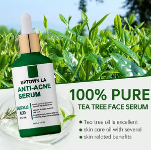 UPTOWN LA Anti Acne Serum 30ml ,Pimple Remove Serum, Dark Spot Remover, Acne Scar Serum, Oil Control Serum, Blackhead Remover Serum, Glowing Skin Serum, Whitening Acne Serum, Best Serum for Pimples, Oily Skin Care Serum, Face Serum for Men, Face Serum