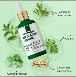UPTOWN LA Anti Acne Serum 30ml ,Pimple Remove Serum, Dark Spot Remover, Acne Scar Serum, Oil Control Serum, Blackhead Remover Serum, Glowing Skin Serum, Whitening Acne Serum, Best Serum for Pimples, Oily Skin Care Serum, Face Serum for Men, Face Serum